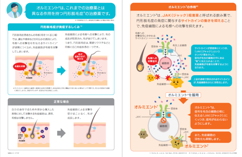 一目でわかるローマの脱毛治療の長所と短所